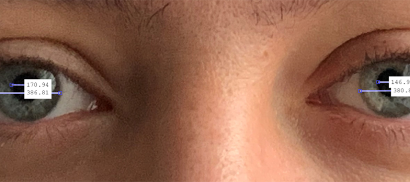 Nahaufnahme der menschlichen Augen mit überlagerten Messdaten, die die Pupillenabstände anzeigen